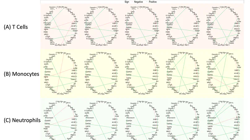 Robust Bayesian Graphical Regression Models for Assessing Tumor Heterogeneity in Proteomic Networks